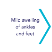Mild swelling of ankles and feet