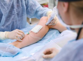 Radiofrequency Ablation therapy